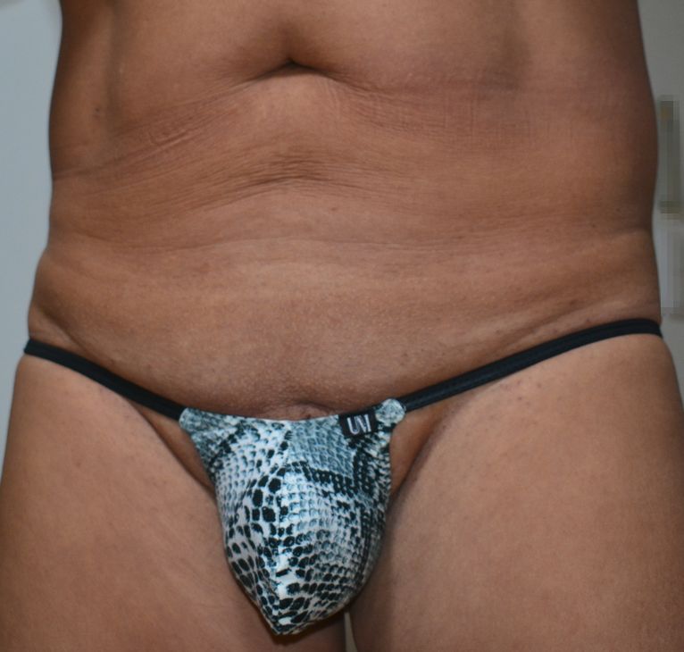 shinさん、約１か月ぶりの報告です。恥ずかしながら、当初９０数