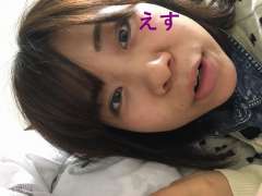 カラーさん  ありがとうございます ネイルで隠したあとはしっかり