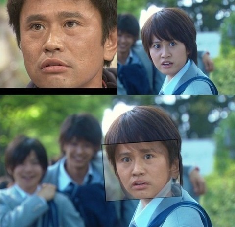 ↑ミス 画像針忘れ