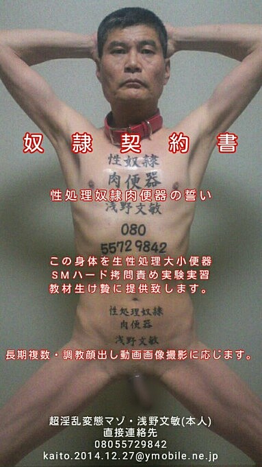 http://imgur.com/a/A403uOS 画像を拾い